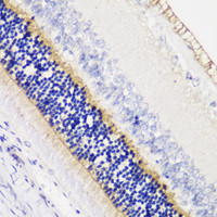Immunohistochemistry of paraffin-embedded Rat retina using ANO2 Polyclonal Antibody at dilution of 1:200 (40x lens) .