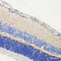 Immunohistochemistry of paraffin-embedded Mouse retina using ANO2 Polyclonal Antibody at dilution of 1:200 (40x lens) .