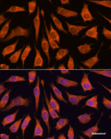 Immunofluorescence analysis of L929 cells using GOLPH3 Polyclonal Antibody at dilution of 1:100. Blue: DAPI for nuclear staining.