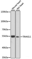 Western blot analysis of extracts of various cell lines using TINAGL1 Polyclonal Antibody at dilution of 1:3000.