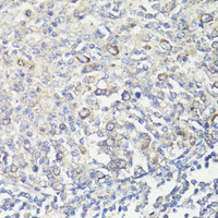 Immunohistochemistry of paraffin-embedded Human tonsil using MUL1 Polyclonal Antibody at dilution of 1:100 (40x lens) .