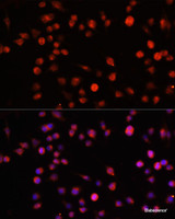 Immunofluorescence analysis of RAW264.7 cells using MUL1 Polyclonal Antibody at dilution of 1:100. Blue: DAPI for nuclear staining.