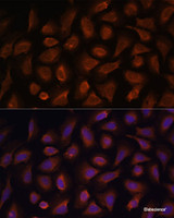 Immunofluorescence analysis of U-2 OS cells using TSLP Polyclonal Antibody at dilution of 1:100. Blue: DAPI for nuclear staining.