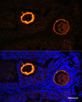 Immunofluorescence analysis of Mouse oophoroma cells using ZP3 Polyclonal Antibody at dilution of 1:100. Blue: DAPI for nuclear staining.