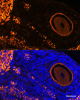 Immunofluorescence analysis of Rat oophoroma cells using ZP3 Polyclonal Antibody at dilution of 1:100. Blue: DAPI for nuclear staining.