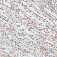 Immunohistochemistry of paraffin-embedded Mouse kidney using ZNF581 Polyclonal Antibody at dilution of 1:100 (40x lens) .