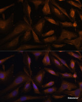 Immunofluorescence analysis of U-2 OS cells using UFC1 Polyclonal Antibody at dilution of 1:100 (40x lens) . Blue: DAPI for nuclear staining.