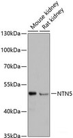 Western blot analysis of extracts of various cell lines using NTN5 Polyclonal Antibody at dilution of 1:3000.