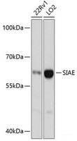 Western blot analysis of extracts of various cell lines using SIAE Polyclonal Antibody at dilution of 1:3000.