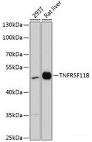 Western blot analysis of extracts of various cell lines using TNFRSF11B Polyclonal Antibody at dilution of 1:3000.