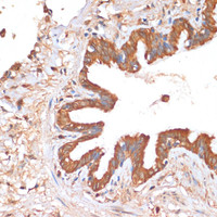 Immunohistochemistry of paraffin-embedded Human lung using HHLA2 Polyclonal Antibody at dilution of 1:100 (40x lens) .