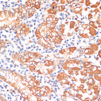 Immunohistochemistry of paraffin-embedded Human stomach using HHLA2 Polyclonal Antibody at dilution of 1:100 (40x lens) .
