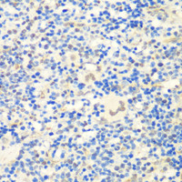 Immunohistochemistry of paraffin-embedded Rat spleen using CTCF Polyclonal Antibody at dilution of 1:200 (40x lens) .