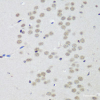 Immunohistochemistry of paraffin-embedded Mouse brain using CTCF Polyclonal Antibody at dilution of 1:200 (40x lens) .