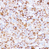 Immunohistochemistry of paraffin-embedded Rat ovary using ACAT1 Polyclonal Antibody at dilution of 1:100 (40x lens) .