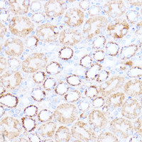 Immunohistochemistry of paraffin-embedded Mouse kidney using ACAT1 Polyclonal Antibody at dilution of 1:100 (40x lens) .