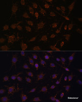 Immunofluorescence analysis of C6 cells using ACAT1 Polyclonal Antibody at dilution of 1:100. Blue: DAPI for nuclear staining.