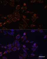 Immunofluorescence analysis of NIH-3T3 cells using ACAT1 Polyclonal Antibody at dilution of 1:100. Blue: DAPI for nuclear staining.