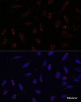 Immunofluorescence analysis of U-2 OS cells using ACAT1 Polyclonal Antibody at dilution of 1:100. Blue: DAPI for nuclear staining.
