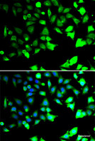 Immunofluorescence analysis of HeLa cells using XIAP Polyclonal Antibody