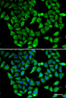 Immunofluorescence analysis of HeLa cells using ASIP Polyclonal Antibody