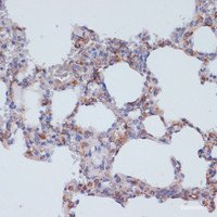 Immunohistochemistry of paraffin-embedded Rat lung using CD40 Polyclonal Antibody at dilution of 1:200 (40x lens) .