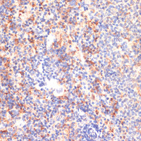 Immunohistochemistry of paraffin-embedded Mouse spleen using CD40 Polyclonal Antibody at dilution of 1:200 (40x lens) .