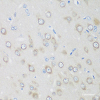 Immunohistochemistry of paraffin-embedded Rat brain using GPI Polyclonal Antibody at dilution of 1:200 (40x lens) .