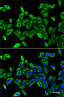 Immunofluorescence analysis of A-549 cells using HADHA Polyclonal Antibody