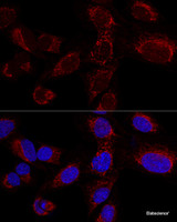 Confocal immunofluorescence analysis of U2OS cells using HADHA Polyclonal Antibody at dilution of 1:100. Blue: DAPI for nuclear staining.