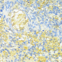 Immunohistochemistry of paraffin-embedded Rat ovary using HLA-DPB1 Polyclonal Antibody at dilution of 1:100 (40x lens) .