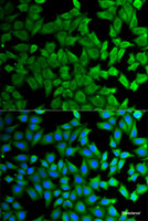 Immunofluorescence analysis of HeLa cells using KLKB1 Polyclonal Antibody