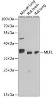 Western blot analysis of extracts of various cell lines using MLF1 Polyclonal Antibody at dilution of 1:1000.