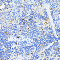 Immunohistochemistry of paraffin-embedded Mouse spleen using PCNA Polyclonal Antibody at dilution of 1:100 (40x lens) .