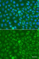 Immunofluorescence analysis of A549 cells using SRGN Polyclonal Antibody