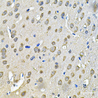Immunohistochemistry of paraffin-embedded Rat brain using PRKAB2 Polyclonal Antibody at dilution of 1:100 (40x lens) .
