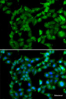 Immunofluorescence analysis of U2OS cells using PRKAB2 Polyclonal Antibody