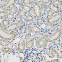 Immunohistochemistry of paraffin-embedded Rat kidney using PYCR1 Polyclonal Antibody at dilution of 1:200 (40x lens) .