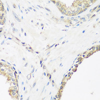 Immunohistochemistry of paraffin-embedded Human prostate using PYCR1 Polyclonal Antibody at dilution of 1:200 (40x lens) .