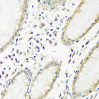 Immunohistochemistry of paraffin-embedded Human stomach using PYCR1 Polyclonal Antibody at dilution of 1:200 (40x lens) .