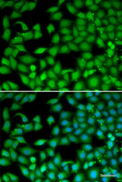 Immunofluorescence analysis of MCF-7 cells using RTKN Polyclonal Antibody