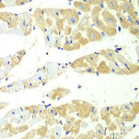Immunohistochemistry of paraffin-embedded Mouse heart using TBXAS1 Polyclonal Antibody at dilution of 1:100 (40x lens) .
