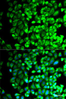 Immunofluorescence analysis of HeLa cells using TBXAS1 Polyclonal Antibody