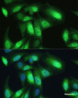 Immunofluorescence analysis of U-2 OS cells using VCP Polyclonal Antibody at dilution of 1:100. Blue: DAPI for nuclear staining.