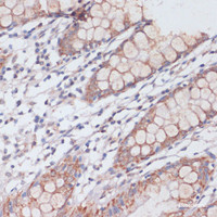 Immunohistochemistry of paraffin-embedded Human colon using MBTPS1 Polyclonal Antibody at dilution of 1:100 (40x lens) .