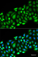 Immunofluorescence analysis of HeLa cells using RIPK2 Polyclonal Antibody