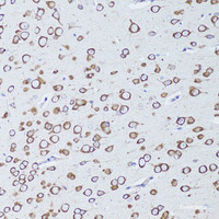 Immunohistochemistry of paraffin-embedded Mouse brain using TNFRSF11A Polyclonal Antibody at dilution of 1:100 (20x lens) .