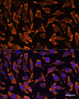 Immunofluorescence analysis of L929 cells using TNFRSF11A Polyclonal Antibody at dilution of 1:100 (40x lens) . Blue: DAPI for nuclear staining.