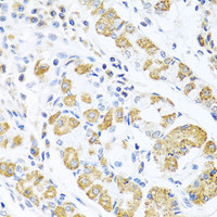 Immunohistochemistry of paraffin-embedded Human stomach using EDIL3 Polyclonal Antibody at dilution of 1:100 (40x lens) .