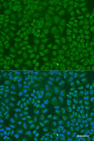 Immunofluorescence analysis of U2OS cells using TARDBP Polyclonal Antibody at dilution of 1:100. Blue: DAPI for nuclear staining.